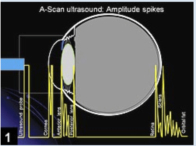 A-scan ultralydsbiometri